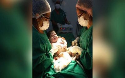 Nace un bebé gigante en BRASIL